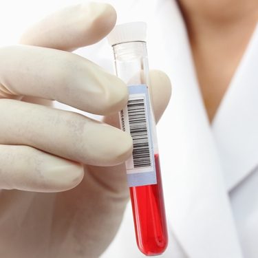 Analiza VSH – sănătate-analize medicale